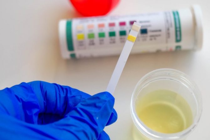Diabetic Proteinuria Testimony from Mr Tan, Singapore 糖尿病肾病微量蛋白尿