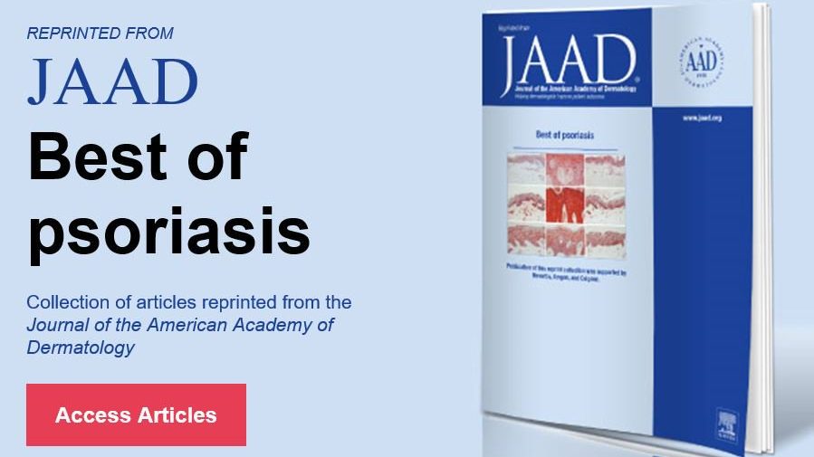 Patient-reported reasons for the discontinuation of commonly used treatments for moderate to severe psoriasis