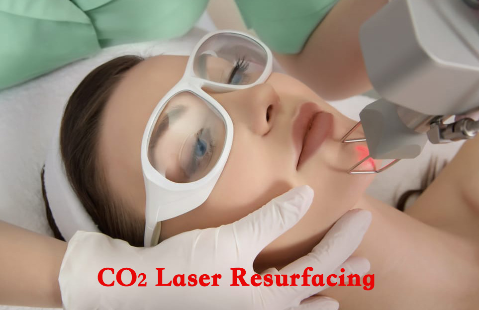 Facial Erosive Pustular Dermatosis After Cosmetic Resurfacing 激光技术镭射磨皮导致面部糜烂性脓疱性皮肤病
