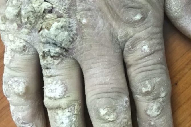 Know the medicine before you take it 皮肤用药三思而后行