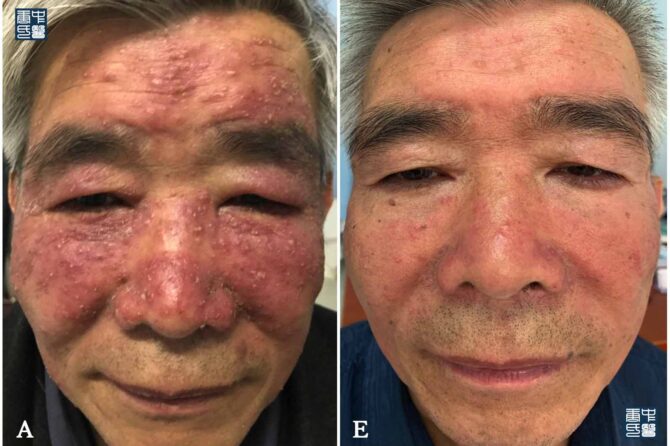 “I was sick, I want the people to know that I am healed,” he said. 照顾他人的人，必蒙神帮助眷顾。