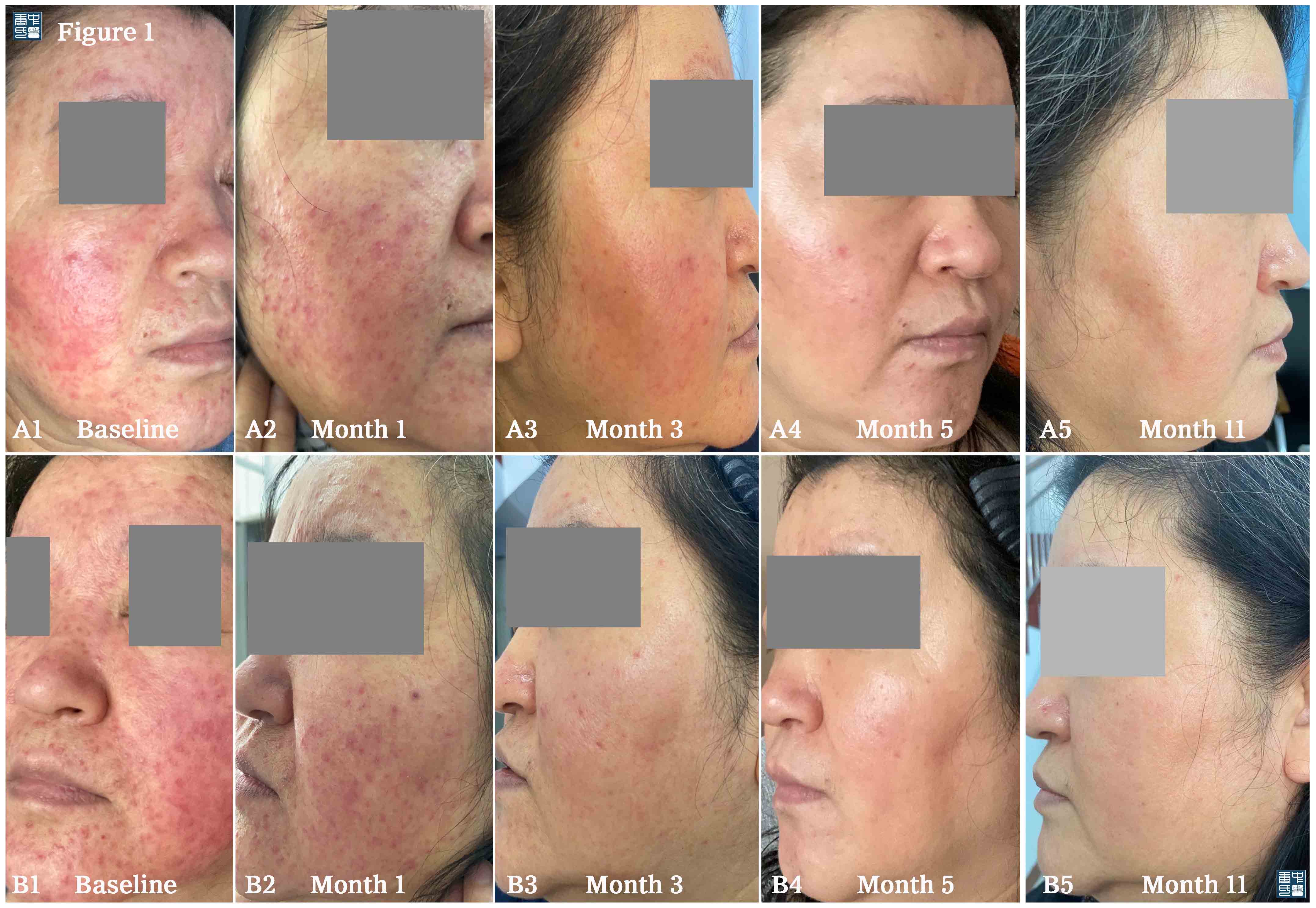 case09-8