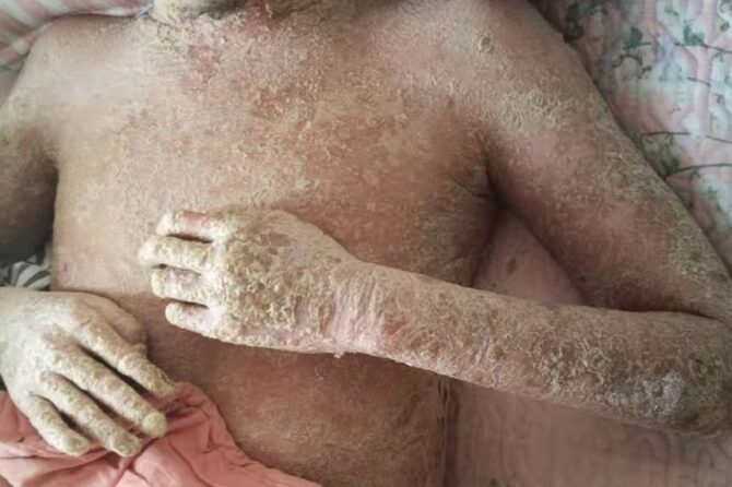 A Sad Story 一个令人悲伤的故事