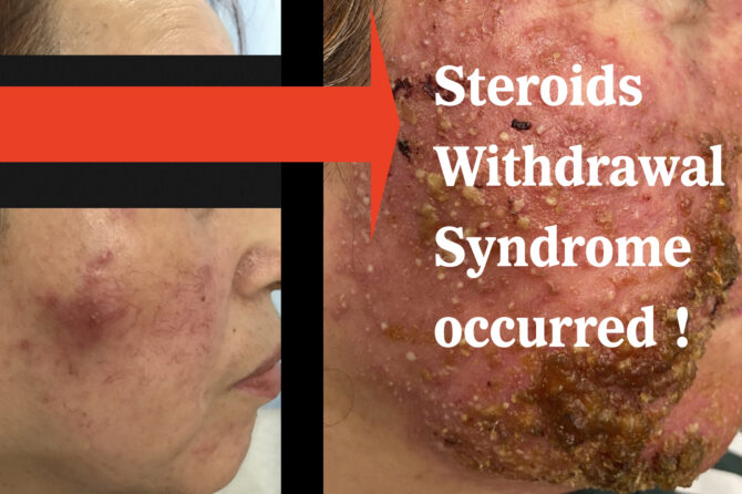 What is a possible diagnosis of this case? 可能性的诊断是什么？