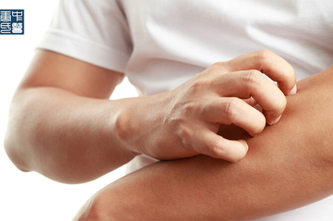 Understanding Itchy and Dry Skin from a TCM Perspective