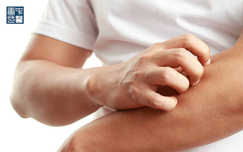 Understanding Itchy and Dry Skin from a TCM Perspective