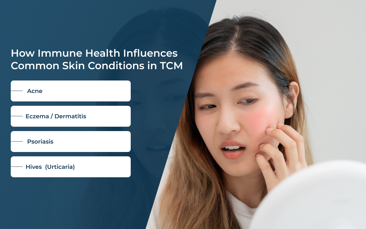 TCM graphic: Immune health influences acne, eczema, psoriasis, hives.
