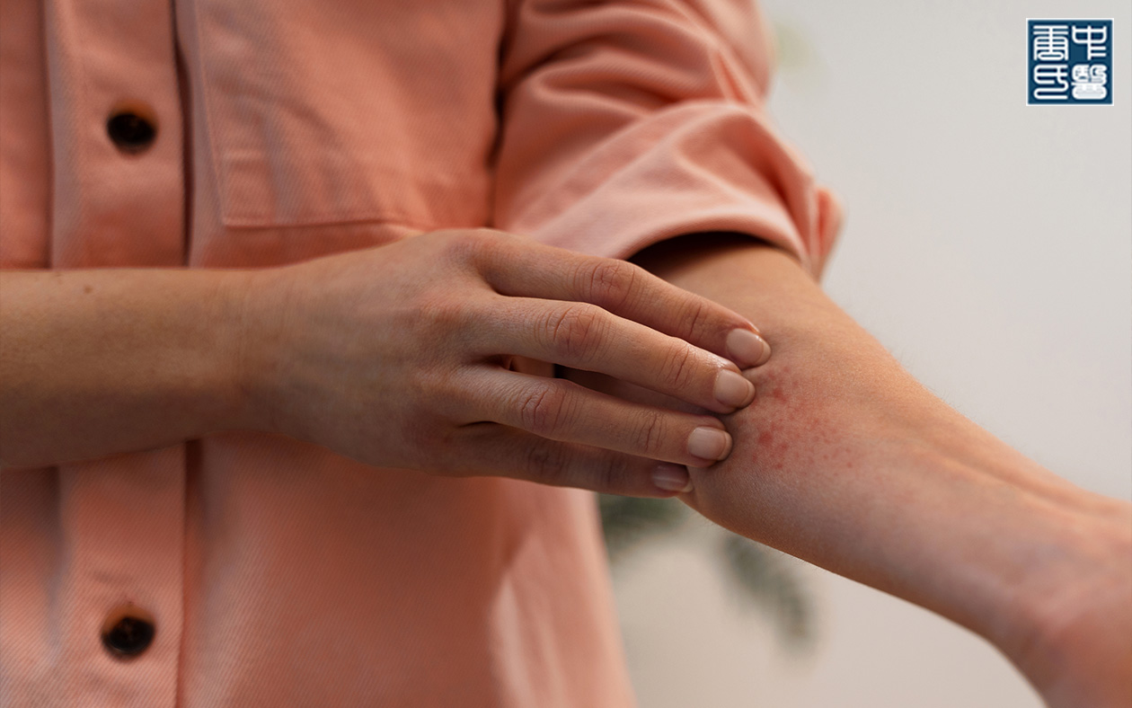 Scratching an arm affected by eczema itching. 