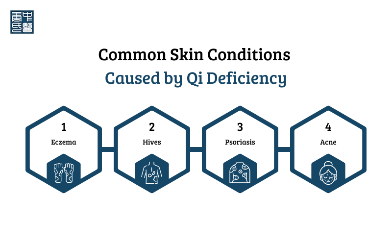 Common skin conditions caused by Qi Deficiency: Eczema, Hives, Psoriasis, Acne.
